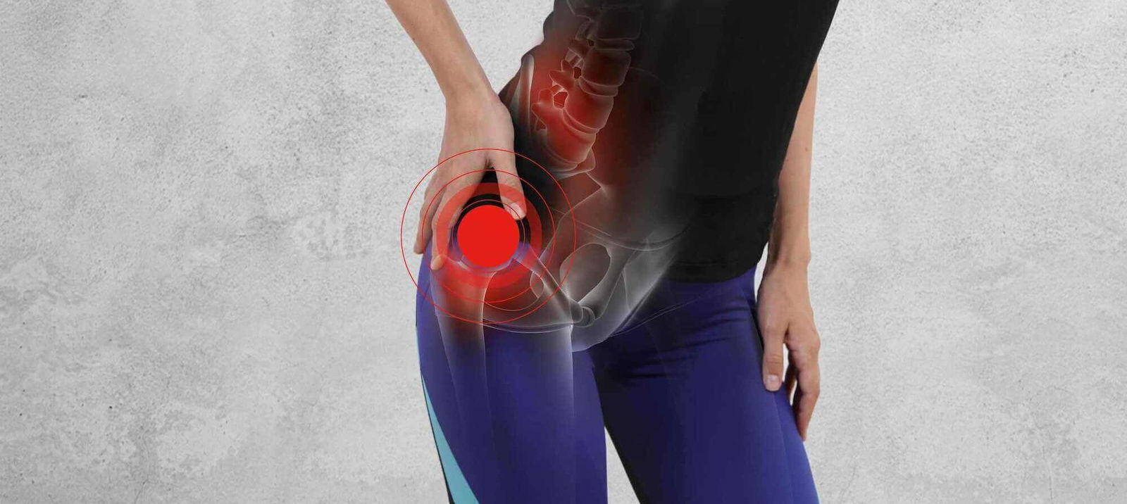 Piriformis sindrom: simptomi, vzroki in zdravljenje